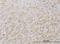 PEAK1 Related, Kinase-Activating Pseudokinase 1 antibody, H00157285-M01, Novus Biologicals, Immunohistochemistry paraffin image 