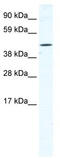 Tetratricopeptide Repeat Domain 19 antibody, TA329950, Origene, Western Blot image 