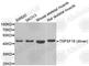 TNF Superfamily Member 18 antibody, A7028, ABclonal Technology, Western Blot image 