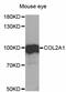 Collagen Type II Alpha 1 Chain antibody, MBS127104, MyBioSource, Western Blot image 