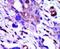 Polo Like Kinase 1 antibody, PA5-15129, Invitrogen Antibodies, Immunohistochemistry paraffin image 