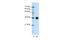 Heterogeneous Nuclear Ribonucleoprotein A0 antibody, 29-394, ProSci, Immunohistochemistry paraffin image 