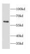 CD69 Molecule antibody, FNab01494, FineTest, Western Blot image 