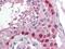 COX2 antibody, NB110-1948, Novus Biologicals, Immunohistochemistry paraffin image 