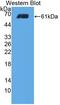 Collagen Type I Alpha 2 Chain antibody, LS-C372489, Lifespan Biosciences, Western Blot image 