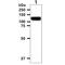 EPH Receptor A2 antibody, GTX57687, GeneTex, Western Blot image 