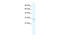 Transient Receptor Potential Cation Channel Subfamily M Member 3 antibody, 28-563, ProSci, Western Blot image 