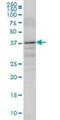 Boule Homolog, RNA Binding Protein antibody, H00066037-M05, Novus Biologicals, Western Blot image 