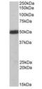 C-Terminal Src Kinase antibody, orb18668, Biorbyt, Western Blot image 