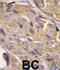 Eukaryotic Translation Initiation Factor 4B antibody, abx025093, Abbexa, Immunohistochemistry paraffin image 