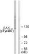 Protein Tyrosine Kinase 2 antibody, LS-C198951, Lifespan Biosciences, Western Blot image 