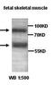 ADAM Metallopeptidase With Thrombospondin Type 1 Motif 1 antibody, orb76986, Biorbyt, Western Blot image 