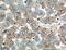 SSH-2L antibody, 20674-1-AP, Proteintech Group, Immunohistochemistry paraffin image 