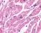 Adrenoceptor Beta 2 antibody, NLS2656, Novus Biologicals, Immunohistochemistry frozen image 