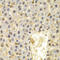 Ubiquitin D antibody, A01970, Boster Biological Technology, Immunohistochemistry paraffin image 