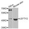 Left-right determination factor 2 antibody, STJ111888, St John