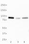 Bruton Tyrosine Kinase antibody, NB110-87047, Novus Biologicals, Western Blot image 