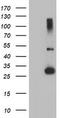 Regulatory Factor X Associated Ankyrin Containing Protein antibody, CF504273, Origene, Western Blot image 