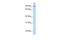 C2CD2 Like antibody, GTX46364, GeneTex, Western Blot image 