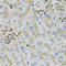 Alanyl-TRNA Synthetase antibody, LS-C409414, Lifespan Biosciences, Immunohistochemistry paraffin image 