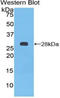 PTCH antibody, LS-C295775, Lifespan Biosciences, Western Blot image 