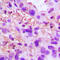 TNF Alpha Induced Protein 6 antibody, GTX55175, GeneTex, Immunohistochemistry paraffin image 