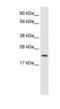 MYCL Proto-Oncogene, BHLH Transcription Factor antibody, PA1-30045, Invitrogen Antibodies, Western Blot image 