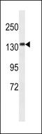 Calmodulin-regulated spectrin-associated protein 3 antibody, GTX53507, GeneTex, Western Blot image 