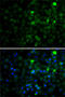 SET And MYND Domain Containing 4 antibody, 22-854, ProSci, Immunofluorescence image 