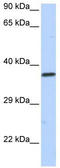 Scm Polycomb Group Protein Like 1 antibody, TA339138, Origene, Western Blot image 