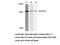 Aryl Hydrocarbon Receptor antibody, LS-C175896, Lifespan Biosciences, Western Blot image 