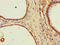 IMP-3 antibody, LS-C397305, Lifespan Biosciences, Immunohistochemistry paraffin image 