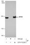 Myosin Heavy Chain 9 antibody, GTX113236, GeneTex, Immunoprecipitation image 