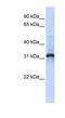 Zinc Finger Protein 705D antibody, NBP1-79367, Novus Biologicals, Western Blot image 