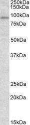 STAT3 antibody, EB07379, Everest Biotech, Western Blot image 