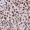 H2B/g antibody, HPA042205, Atlas Antibodies, Immunohistochemistry paraffin image 