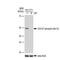 Cell Division Cycle 37 antibody, GTX03250, GeneTex, Western Blot image 