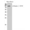 Dynamin 1 antibody, LS-C381041, Lifespan Biosciences, Western Blot image 