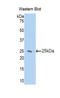 Zinc Finger AN1-Type Containing 6 antibody, LS-C297030, Lifespan Biosciences, Western Blot image 