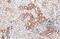 Caspase 1 antibody, GTX101322, GeneTex, Immunohistochemistry paraffin image 