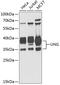 Uracil-DNA glycosylase antibody, GTX55836, GeneTex, Western Blot image 