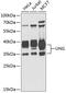 Uracil DNA Glycosylase antibody, GTX55836, GeneTex, Western Blot image 