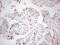 p21 antibody, LS-C794332, Lifespan Biosciences, Immunohistochemistry paraffin image 