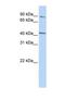 Ferrochelatase antibody, NBP1-54841, Novus Biologicals, Western Blot image 