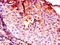 Cathepsin B antibody, A51869-100, Epigentek, Immunohistochemistry paraffin image 