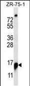 Ribonuclease P And MRP Subunit P25 antibody, PA5-48511, Invitrogen Antibodies, Western Blot image 