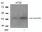 JunB Proto-Oncogene, AP-1 Transcription Factor Subunit antibody, GTX50106, GeneTex, Western Blot image 