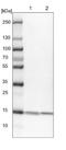 NME/NM23 Nucleoside Diphosphate Kinase 2 antibody, NBP2-13662, Novus Biologicals, Western Blot image 