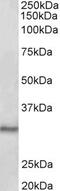 CTD Small Phosphatase 1 antibody, PA5-37961, Invitrogen Antibodies, Western Blot image 