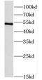 Coronin 2B antibody, FNab01884, FineTest, Western Blot image 